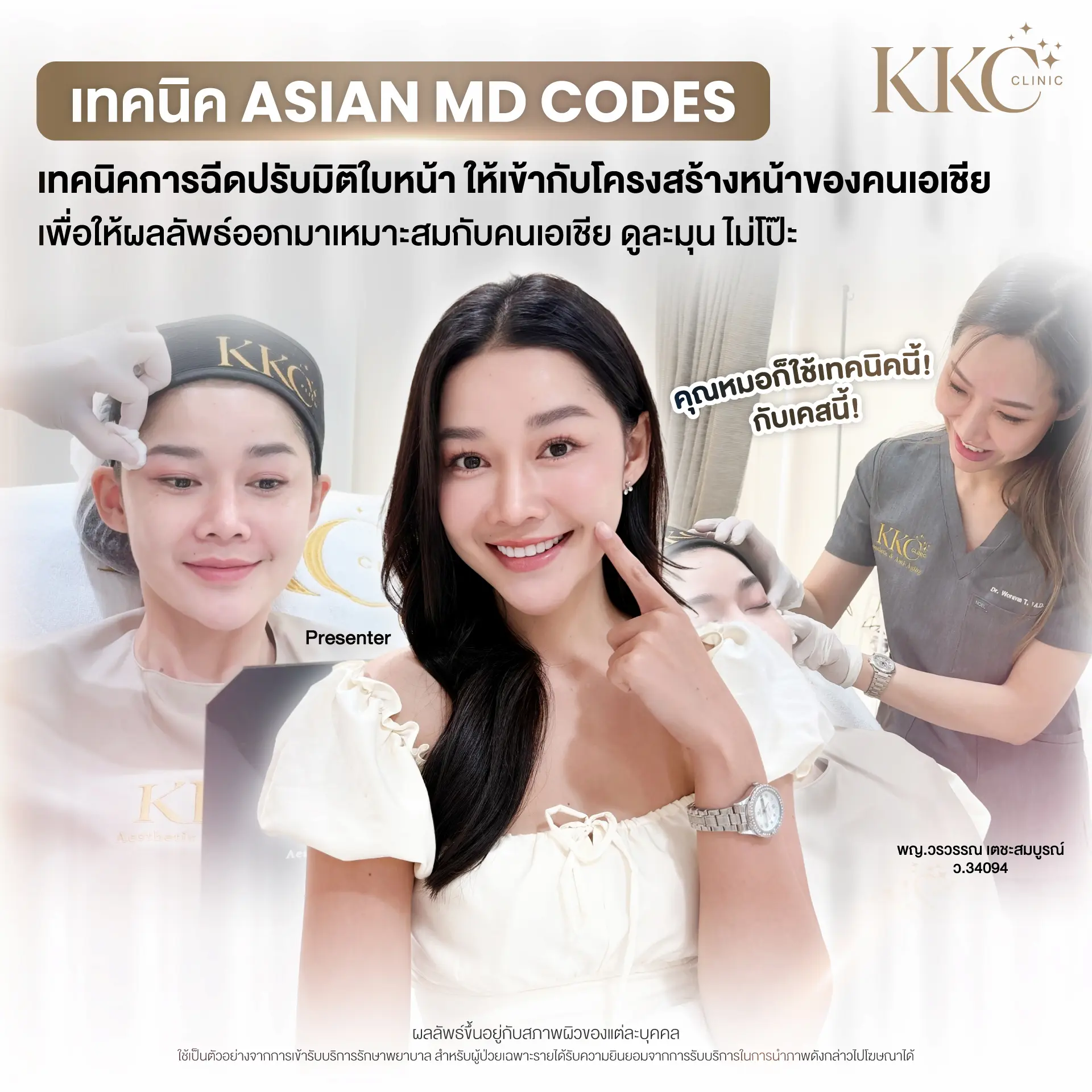 asian-md-codes-filler-technique-natural-look-dr-ple-kkc-clinic