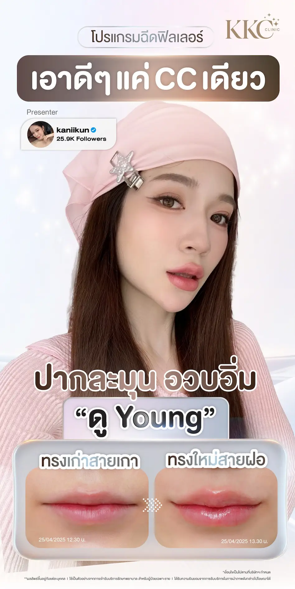 เปรียบเทียบทรง ฉีดฟิลเลอร์ ปากสายเกา vs สายฝอ ปั้นทรงสวยดูแพง โดยทีมแพทย์ KKC