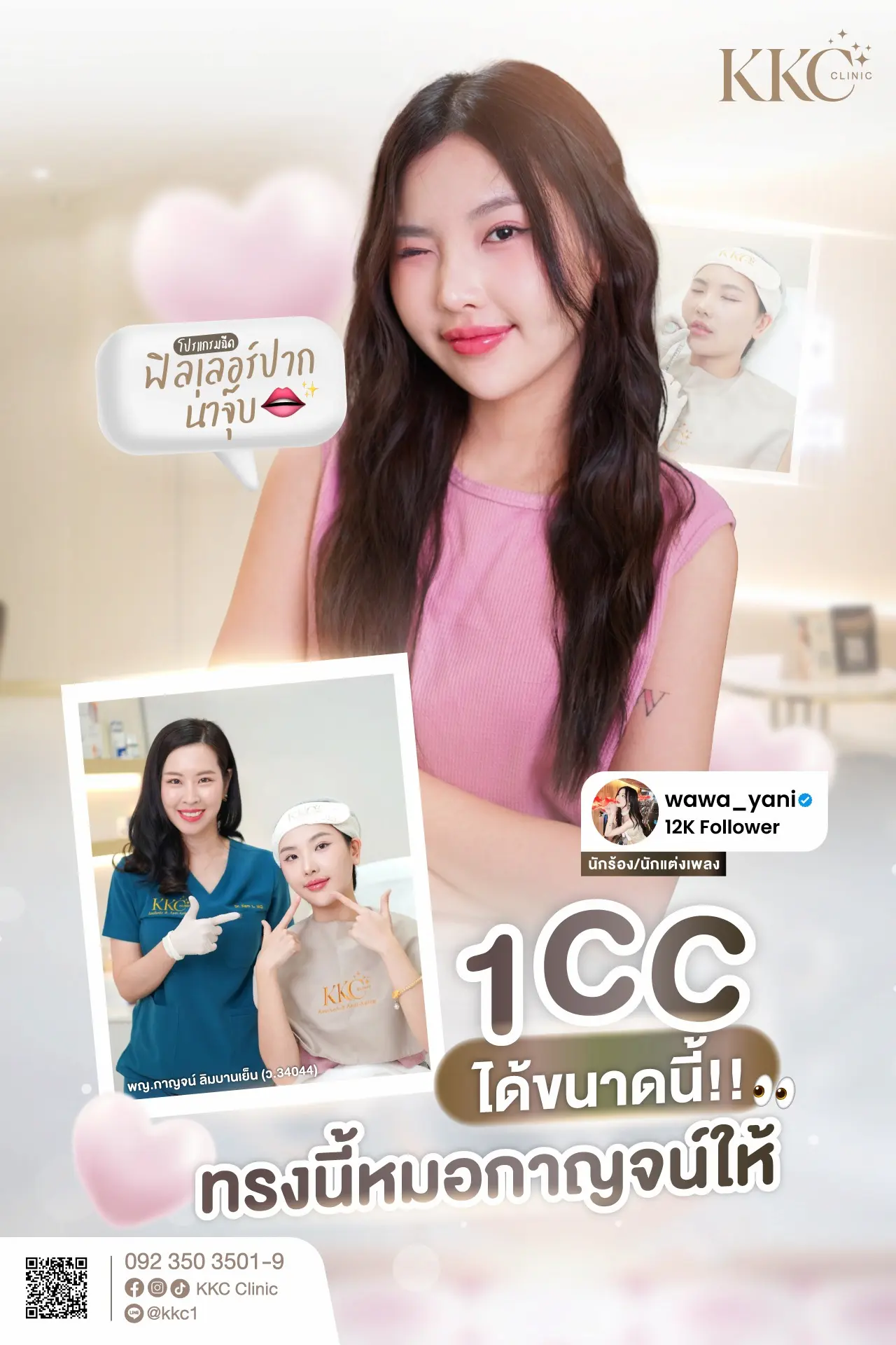 รีวิว ฉีดฟิลเลอร์ ปาก 1 CC ทรงสวยน่าจุ๊บ ออกแบบโดย หมอกาญจน์ KKC Clinic