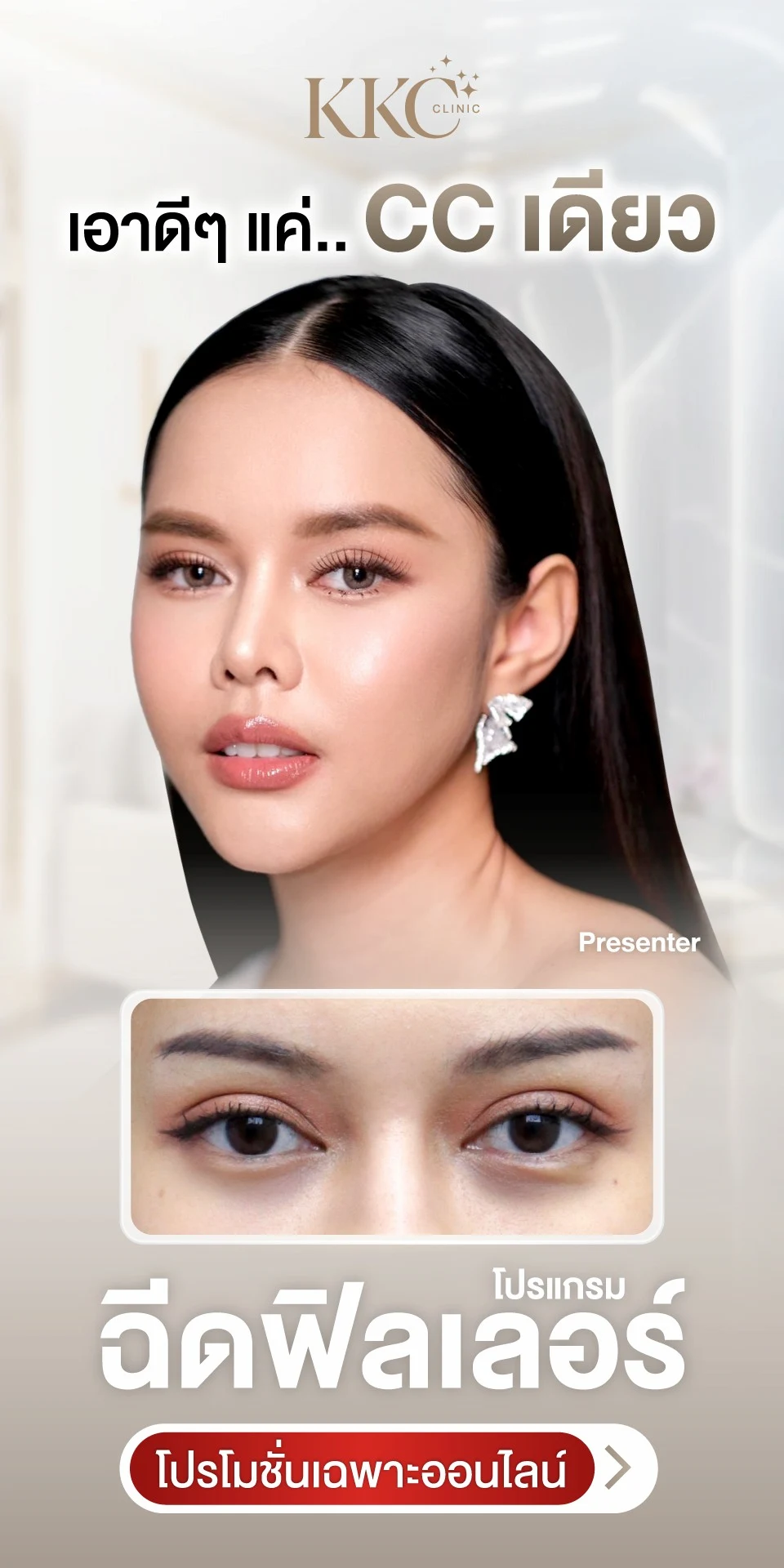โปรโมชั่น ฉีดฟิลเลอร์ ใต้ตา 1 CC แก้ขอบตาดำ ร่องลึก สิทธิพิเศษจองออนไลน์