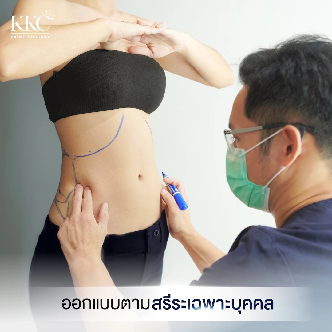 หมอพีรเจษฏ์ ออกแบบเคส ดูดไขมัน ตามสรีระเฉพาะบุคคล