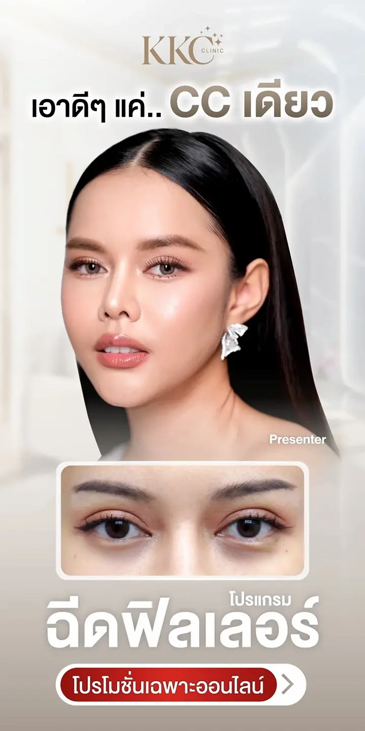โปรโมชั่น ฉีดฟิลเลอร์ ใต้ตา 1 CC แก้ขอบตาดำ ร่องลึก สิทธิพิเศษจองออนไลน์